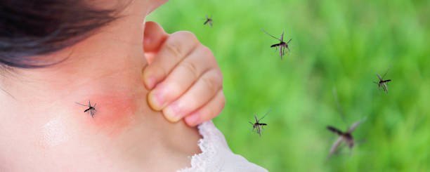Dengue fever is an infection caused by viruses called the “dengue viruses.