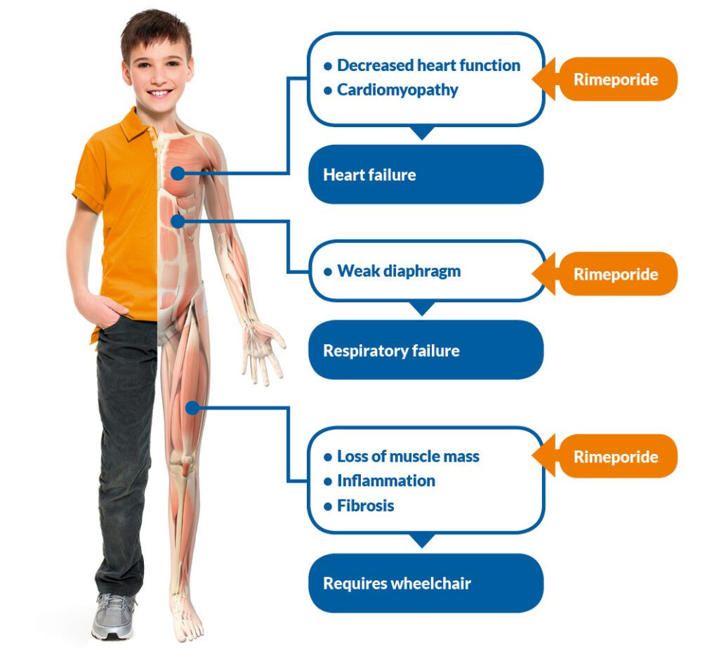 INHERITED DISEASES—MUSCULAR DYSTROPHIES 