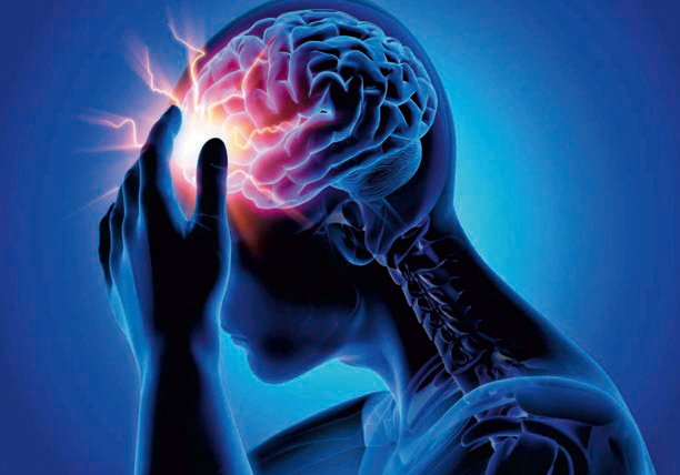 From Migraines to Tumors: Understanding Headache Sources