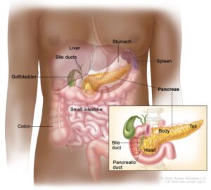 Ayurveda's Personalized Approach to Pancreatic Cancer