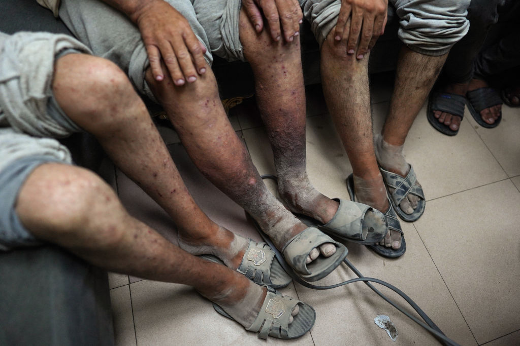 Palestinian men who had been detained by Israeli forces arrive after their release for a check-up at the Al-Aqsa Martyrs Hospital in Deir el-Balah in the central Gaza Strip on July 1, 2024.Bashar Taleb—AFP/Getty Images