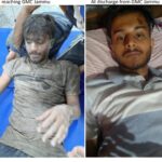 GMC Jammu takes lead in providing World Class treatment to victims of Kishtwar Tragedy